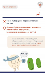 ТУБЕРКУЛЕЗ